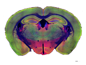 colorful mouse brain with restored brain function